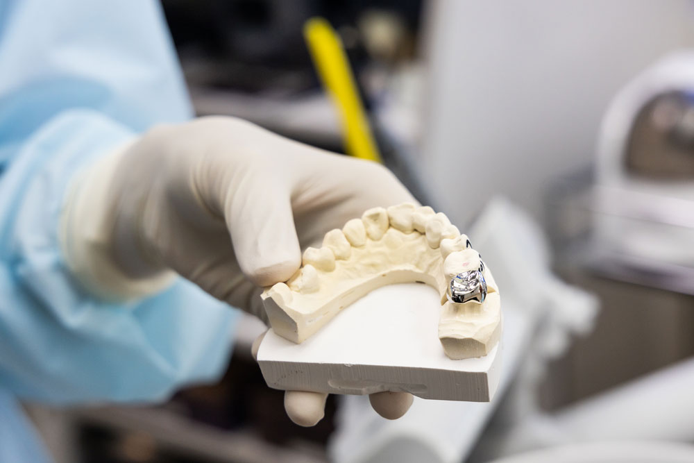 CONQUERING-ANTERIOR-POSTERIOR-COMPOSITE-RESTORATIONS